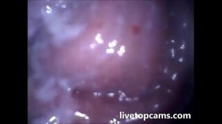 Esmegma na vagina