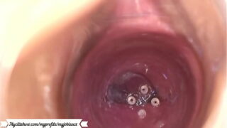 Micro camera na vagina
