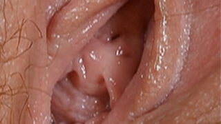 Vulva carnuda